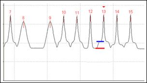 Traditional OSA using the interpolation method to measure the noise at the level of the red bar