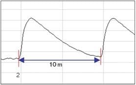 Figure 6. Attenuation dead zone